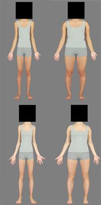 The Thin White Line: Adaptation Suggests a Common Neural Mechanism for Judgments of Asian and Caucasian Body Size